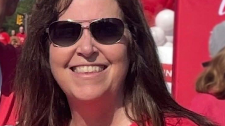 Misty's Before FGS Photo